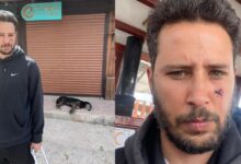 Tuan Tunalı’yı köpek ısırdı!